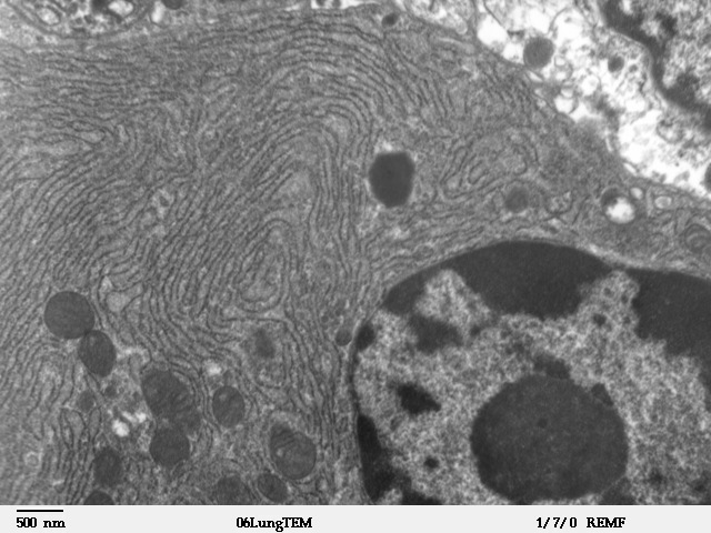 Plik:Clara cell lung - TEM.jpg