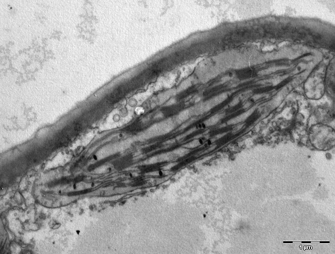 Plik:Chloroplast in leaf of Anemone sp TEM 12000x.png