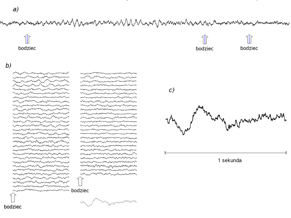 Elektroencefalografiametody Analizy Sygnałów Eeg Analiza W Dziedzinie Czasu Brain Wiki 6337