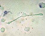 Histologia/Krew szpik kostny i odnowa komórek krwi – Brain-wiki