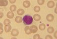 Histologia/Krew szpik kostny i odnowa komórek krwi – Brain-wiki