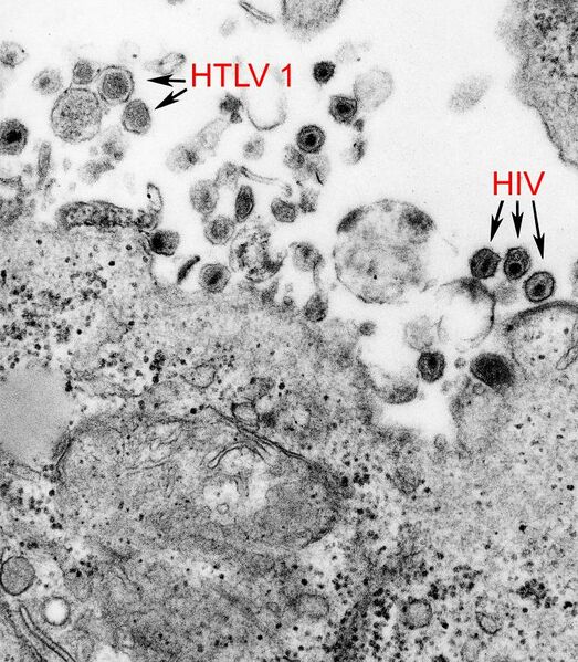 Plik:HTLV-1 and HIV-1 EM 8241 lores.jpg