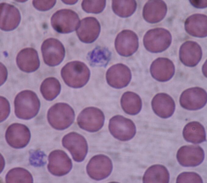 Plik:Giant platelets.JPG
