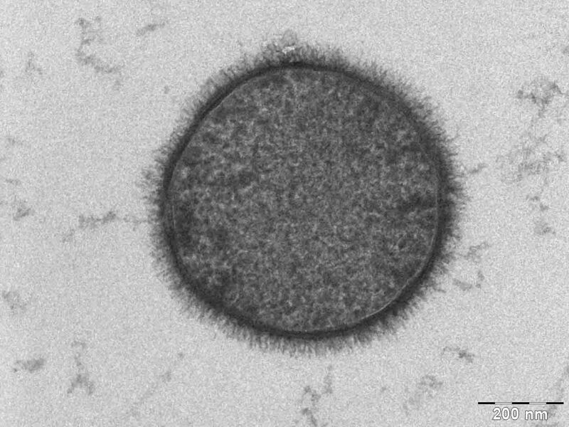 Plik:Bacillus subtilis.jpg