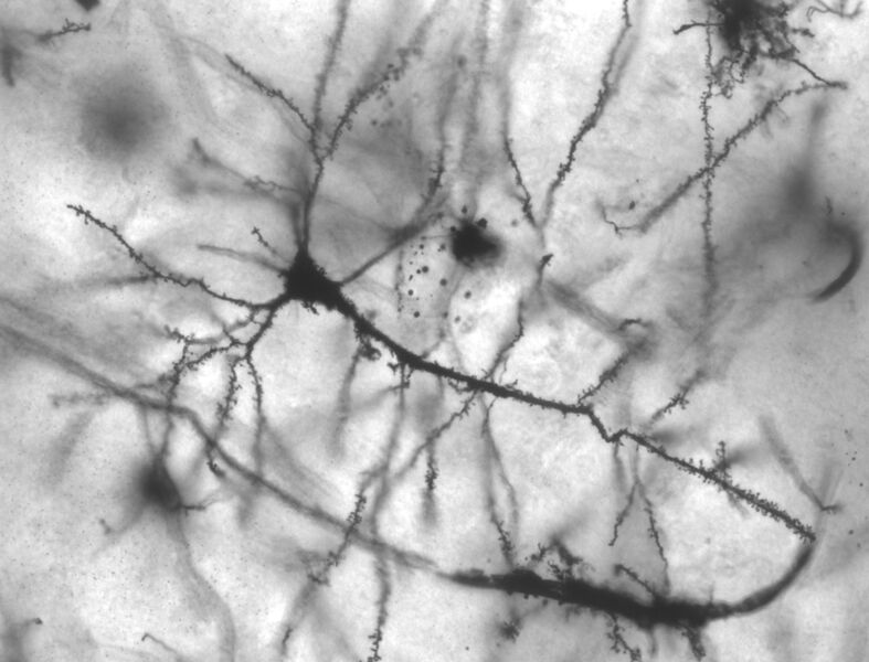 Plik:Pyramidal hippocampal neuron 40x.jpg