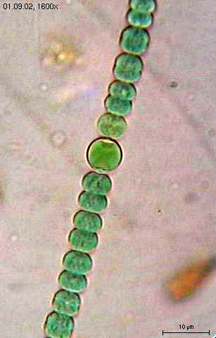 Plik:Anabaena sperica2.jpg